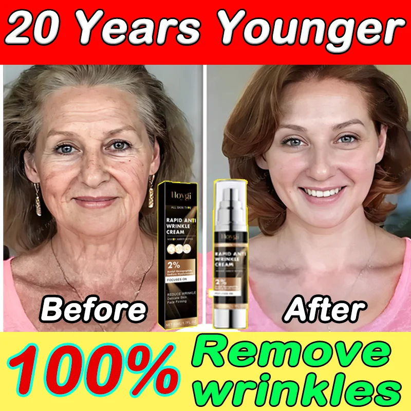 OUHOE Anti-wrinkle Oxys Cream Wrinkle Face Cream Anti Aging Face Lift Facial Massagers Facial Lifting Beauty Health  Skin Care