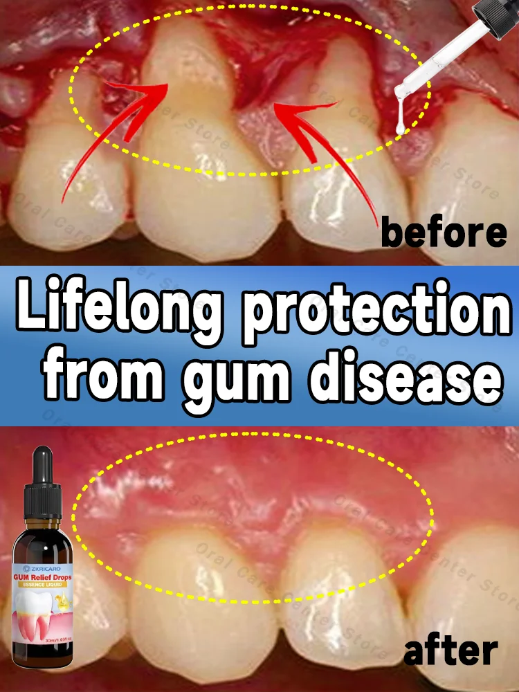 Repair damaged gums, relieve gum pain, and strengthen gums