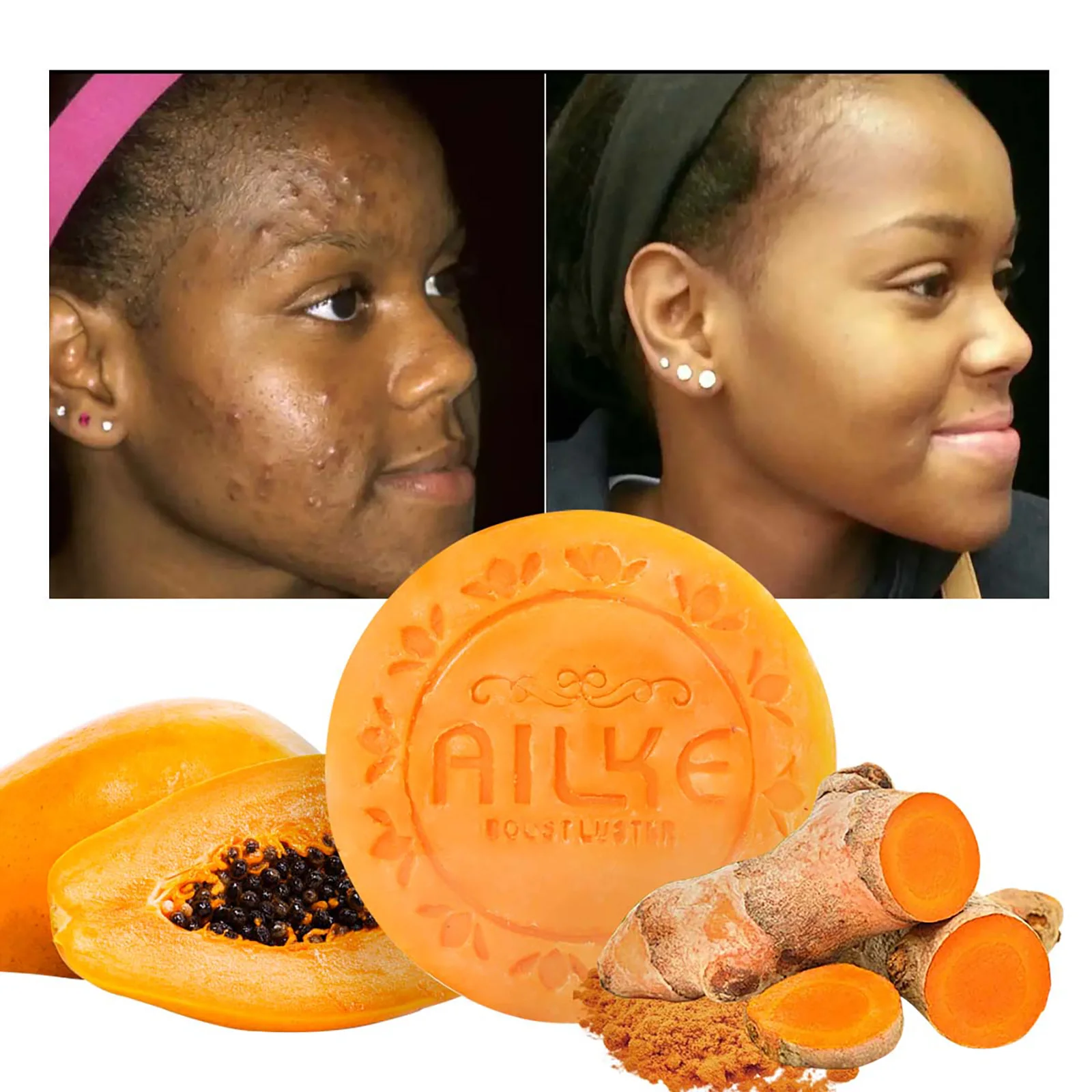 

Осветляющее мыло AILKE с натуральной куркумой, папайей, моркови, удаление темных пятен, прыщей, для всех типов кожи, 200 г