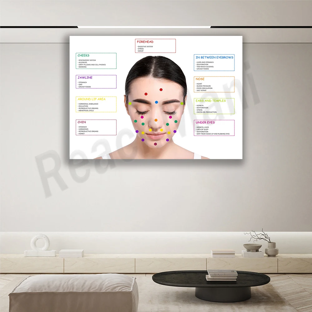 Acne facial diagram detailed poster, medical clinic educational wall decoration