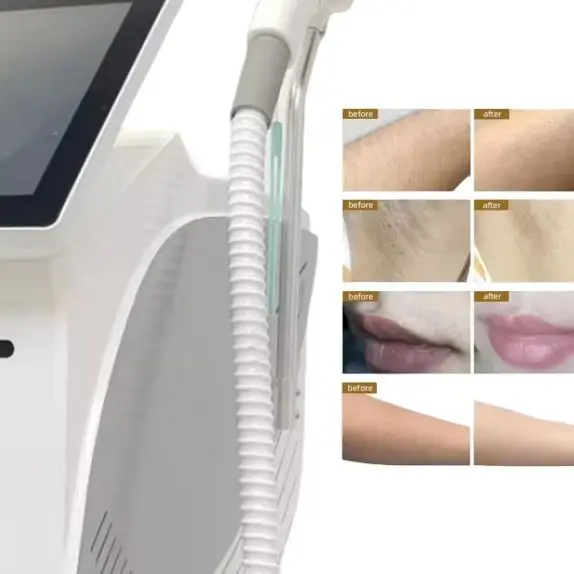 

Профессиональное устройство для удаления волос с диодным лазером 2025: 4000 Вт, 4 волны (755/808/940/1064 нм), ледяное охлаждение для безболезненной постоянной смолы