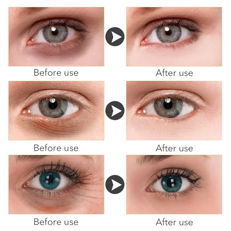 Anti-aging Eye Cream Remove Dark Circles Eye Bags Serum Improve Puffiness Lift Firm Whitening Moisturizing Skin Care Products