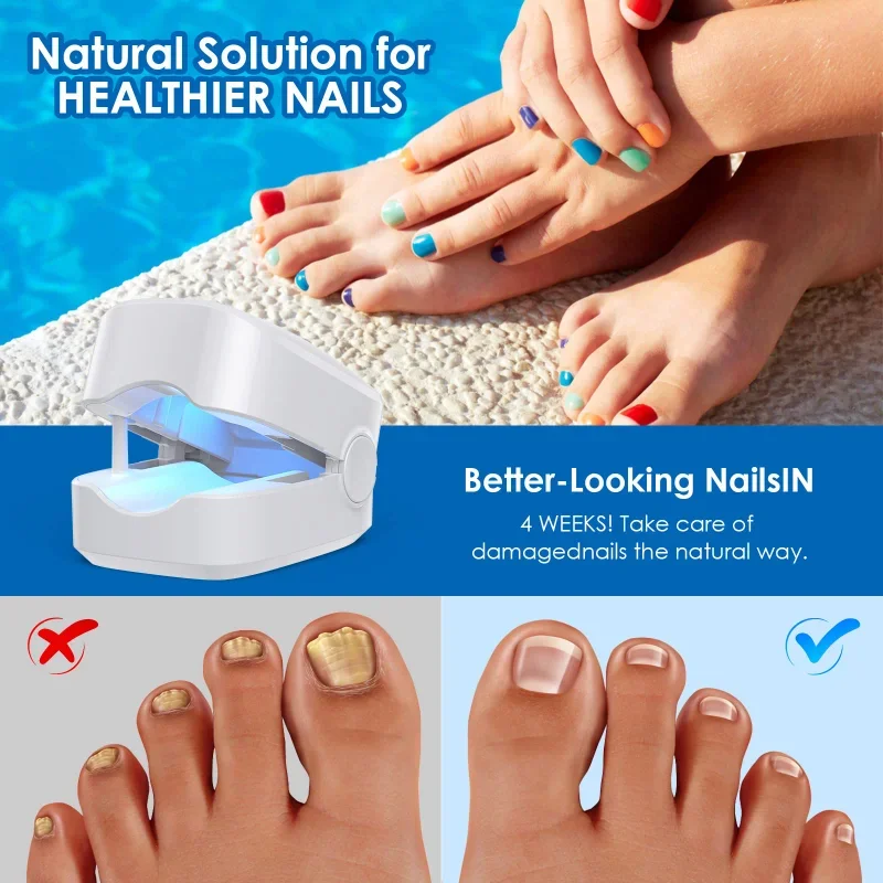 

Nail FungusRepair Laser Device Nail Fungus Treatment Foot Repair Nail Fungus Removal Tools Effectively Remove Fungal Toenail