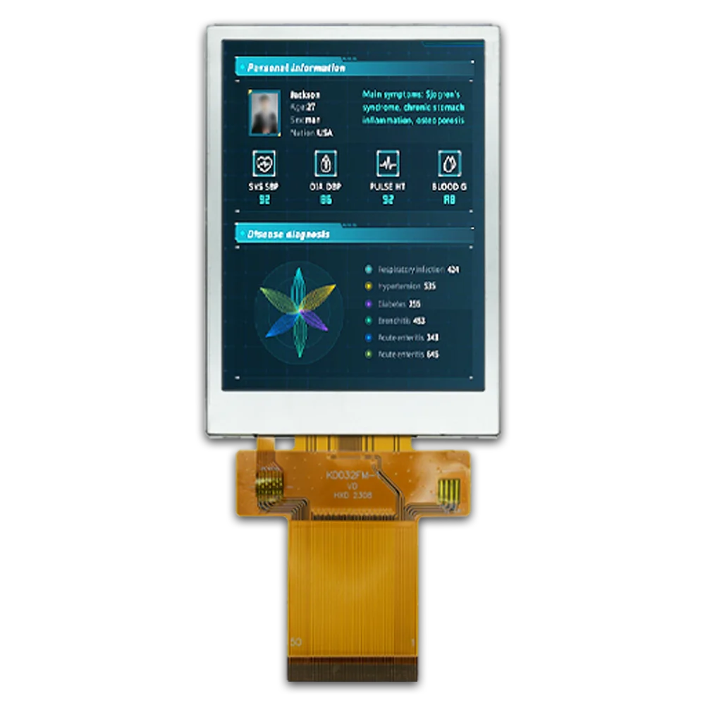 3.2inch IPS LCD 240x320 Resolution display MCU/SPI/RGB Interface Ideal Wide Temperature Range for customized industrial Displays
