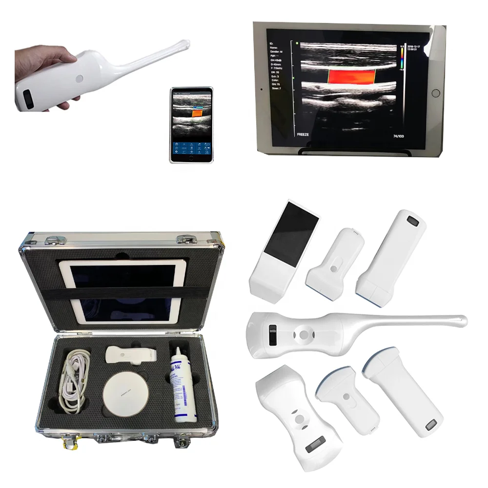 Konted C10RL USB WIFI Портативный беспроводной ультразвуковой зонд выпуклый линейный Konted C10RL USB WIFI Портативный беспроводной ультразвуковой зонд выпуклый линейный