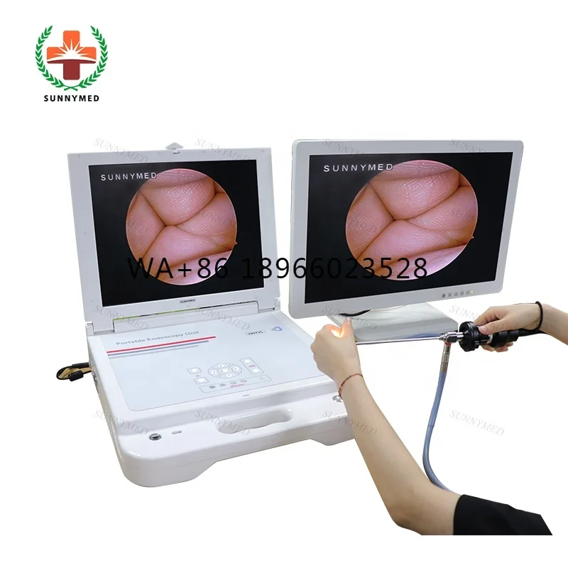 SY-PS045N Telecamera per endoscopio CCD per endoscopio ORL medico con telecamera per endoscopia integrata con sorgente luminosa a LED