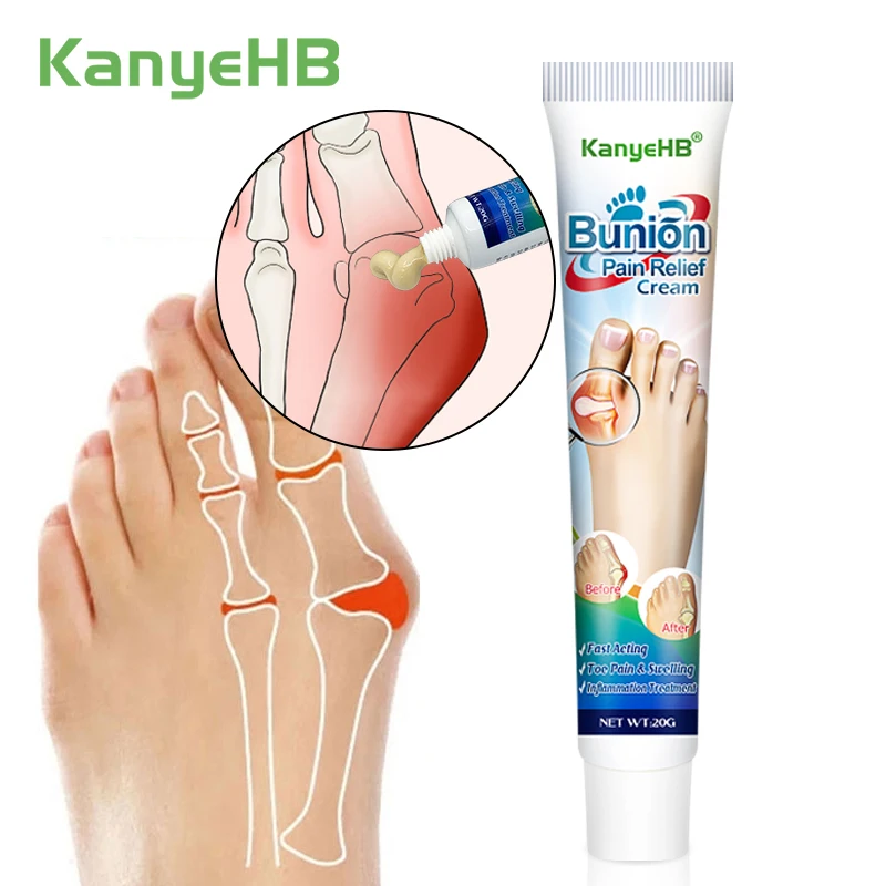 

1Pcs Bunion Gout Pain Relief Ointment Toe Joint Valgus Corrector Cream Hallux Knee Lumbar Arthritis Treatment Medical Cream G019