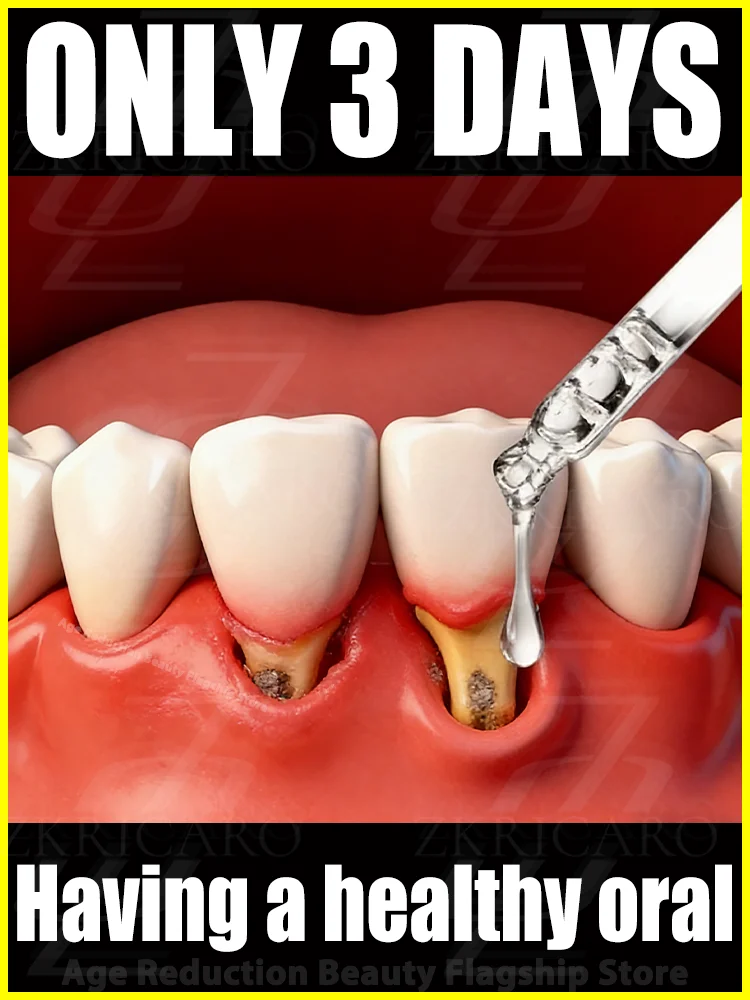 

Eᴀsɪʟʏ Rᴇsᴛᴏʀᴇ Gᴜᴍs Cᴏᴠᴇʀ Tᴇᴇᴛʜ ɪɴ Oɴʟʏ 7 Dᴀʏs