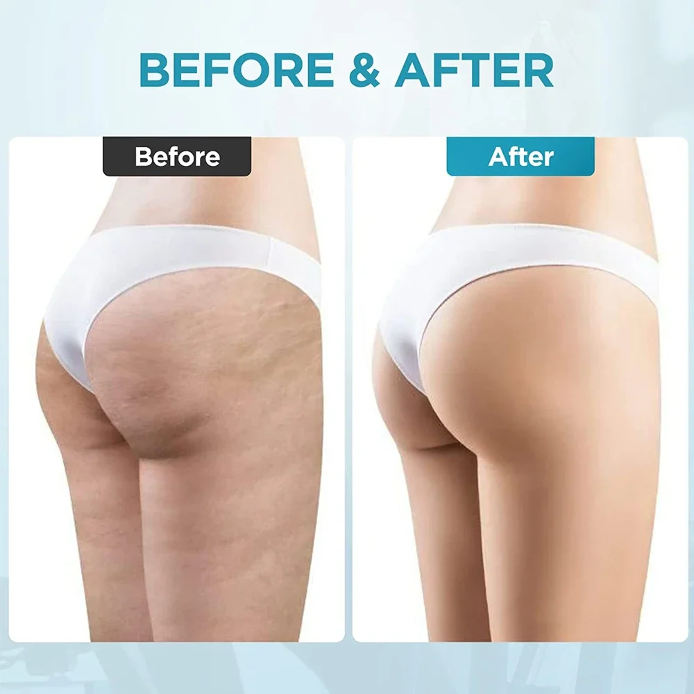 1 個のグアシャフェイシャルツール最高のリンパドレナージグアシャツールフェイスマッサージャーセルライトローラー女性への誕生日プレゼント