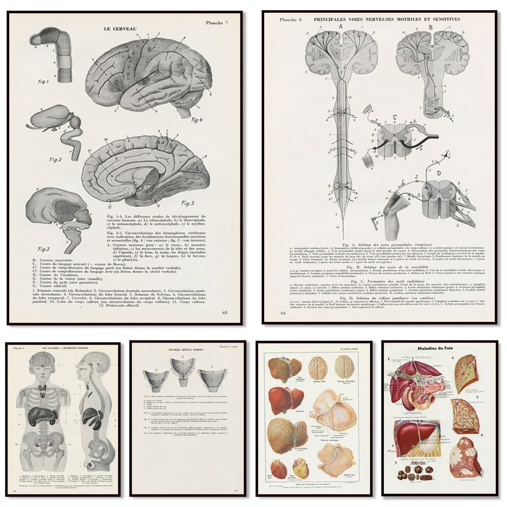 Vintage liver medical print, small glands, brain anatomy, vintage poster, alcohol abuse prevention, medical gift