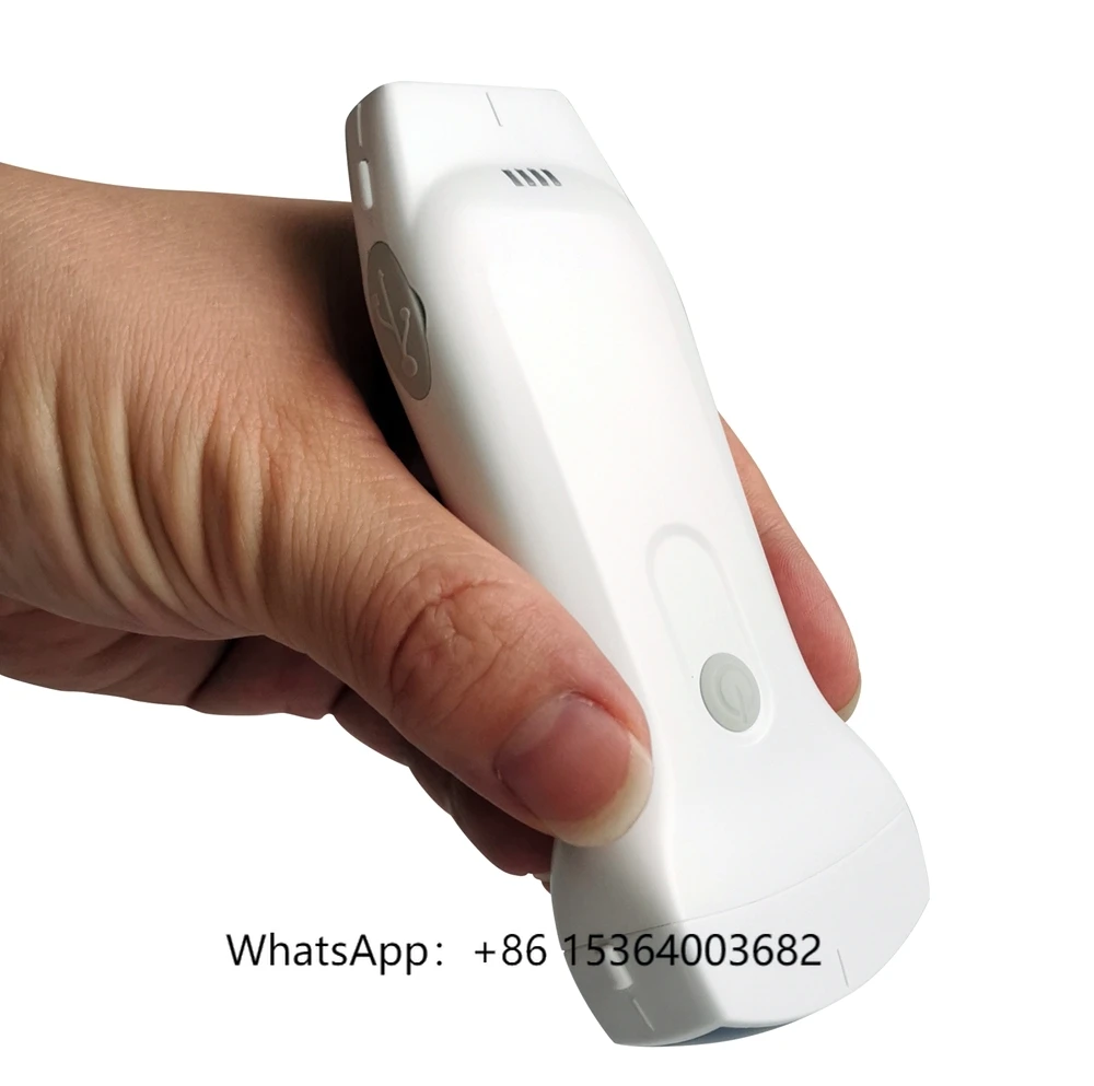 

Best Quality 3 in 1 Wireless Ultrasound Scanner Wireless Ultrasound Machine for Sale