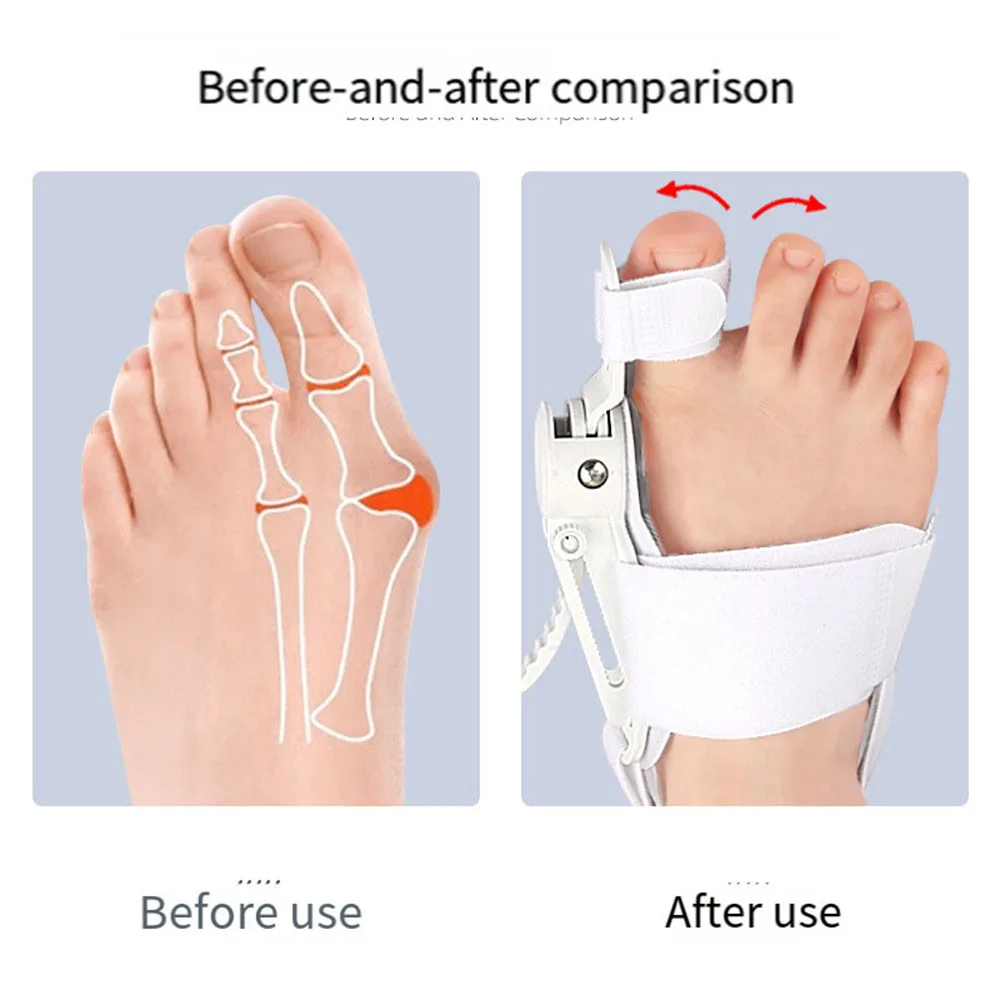 Toe Separator Bunion Corrector Bunions Haluksy Separators Halux Toe Spreader Finger Straightener For Toe Hallux Valgus Corrector