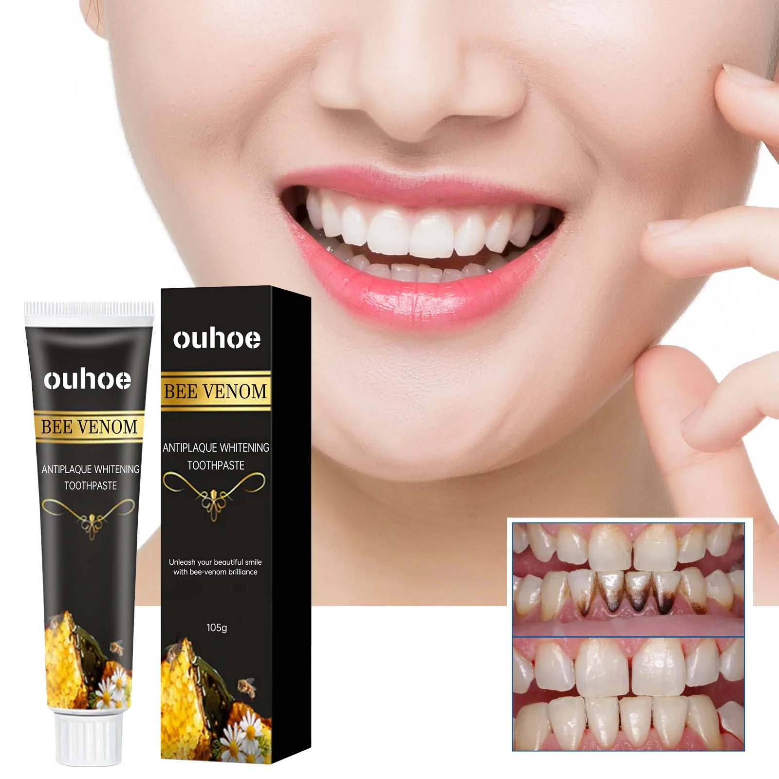 

Whitening Toothpaste – Cares for gums, cleans stains, removes oral odor, whitens teeth