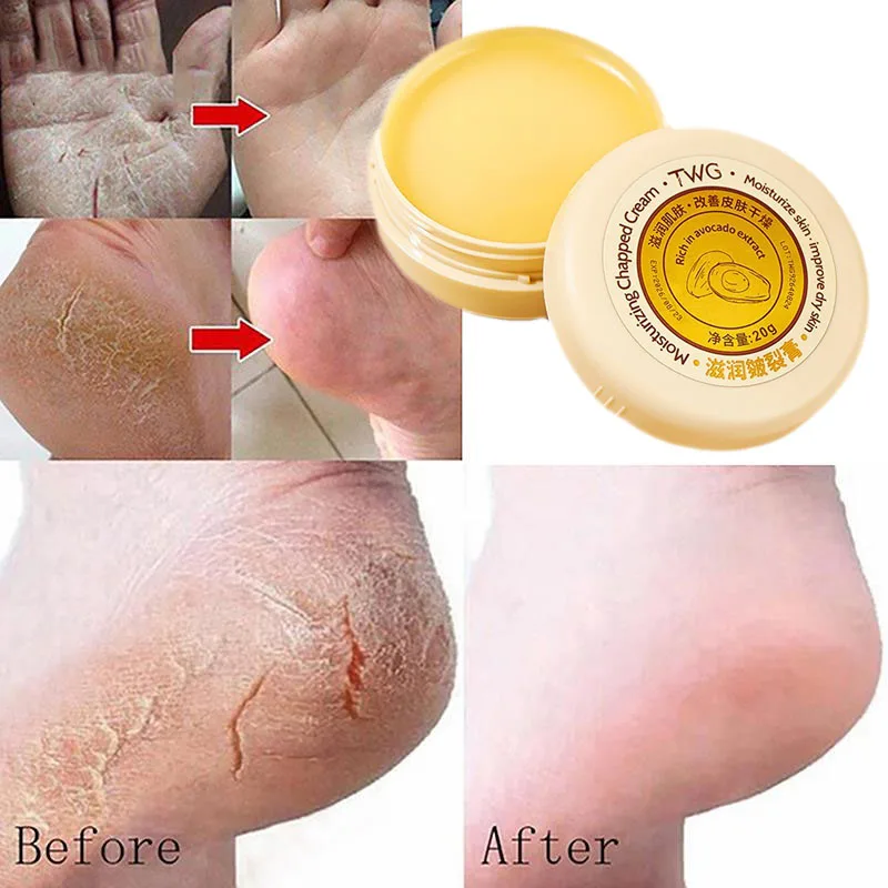 

20g Anti-Drying Crack Foot Cream Hand Cracked Repair Anti-Cracking Moisturizing Exfoliating Heel Mask Removal Callus Whitening