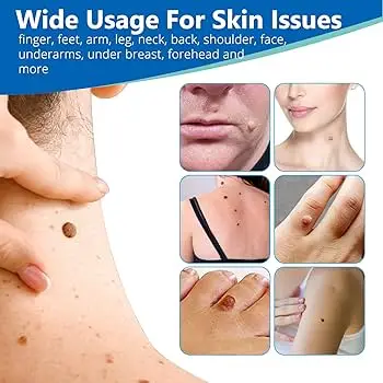 Blue Light, plus de réductions sur les ensembles