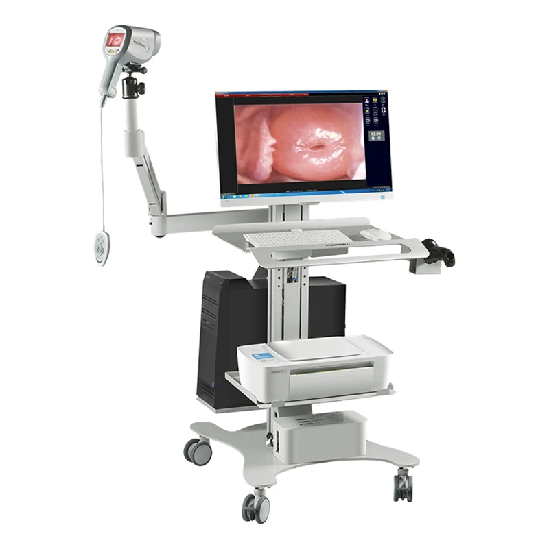 Factory Supply High Quality HKN-2200I Medical Vaginal Video Kernel Price