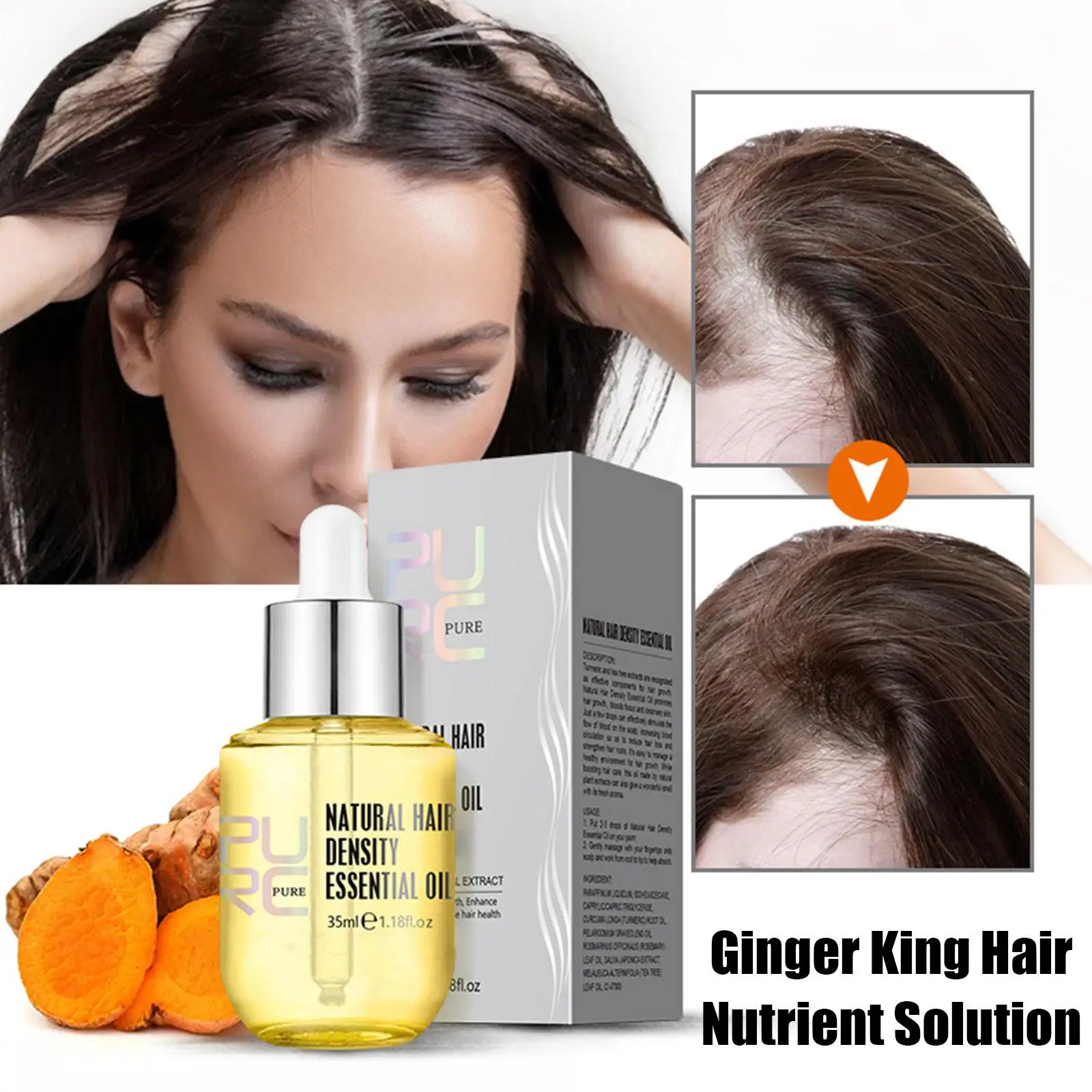 35ml Ginger Natural Hair Density olio essenziale Anti prevenire perdere la ricrescita liquida siero a crescita rapida nutridents Beauty Health Care