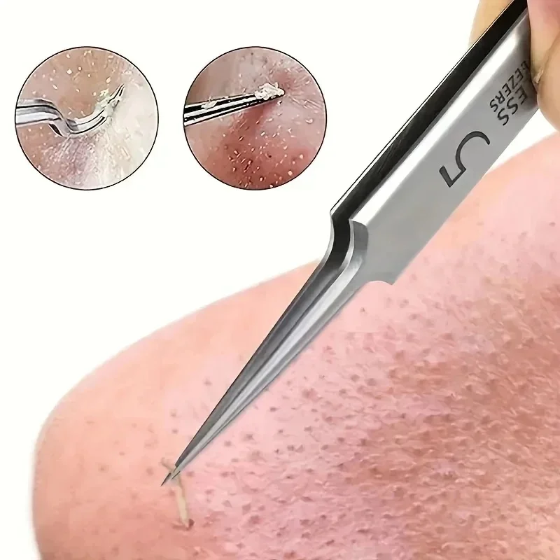 1/2/3/4pcs Ultra-fine Pimples Blackhead Clip Tweezers Beauty Salon Special Scraping Closing Artifact Acne Needle Tools