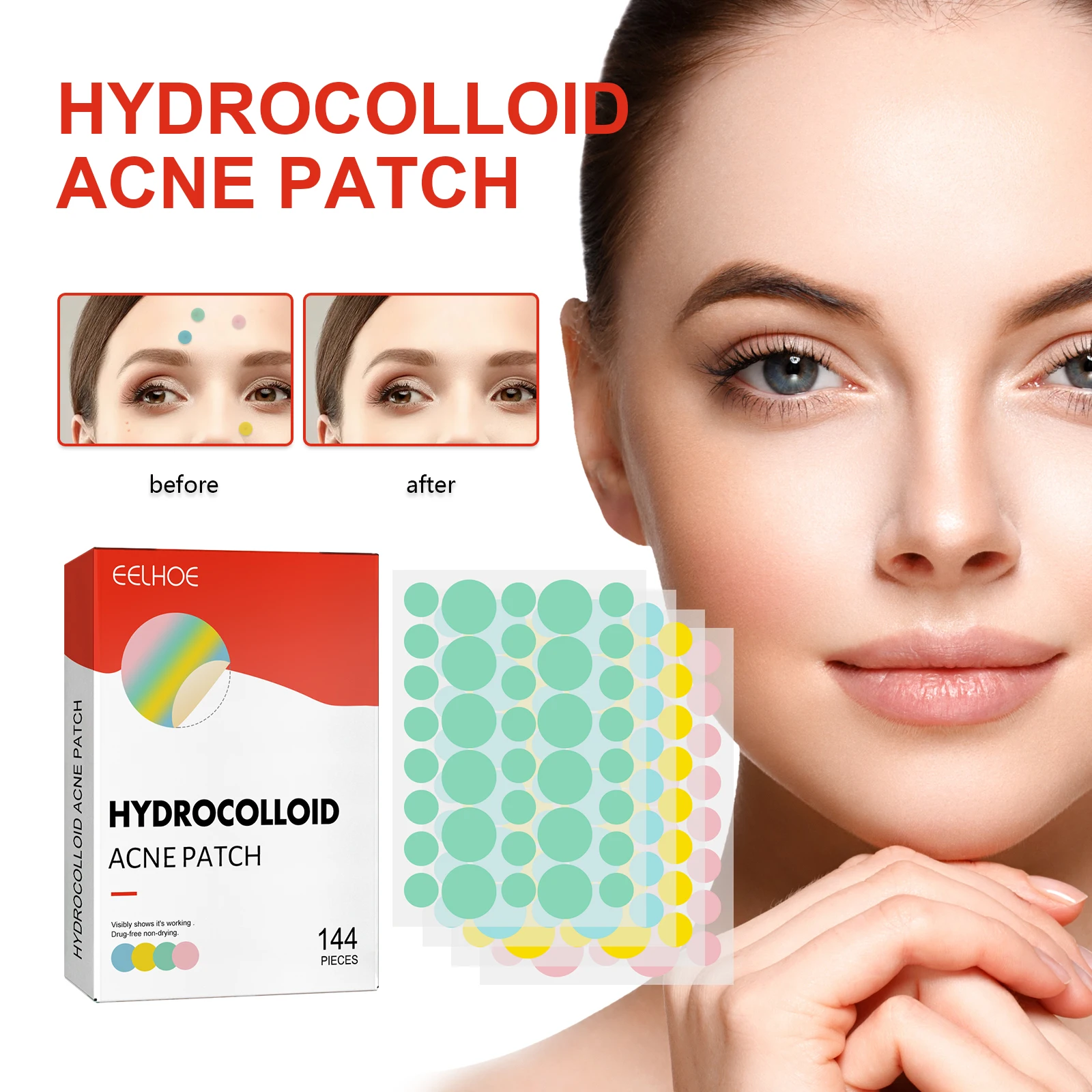 Color Acne Patches, Gentle Hydrocolloid Blemish Treatment, Skin-Friendly Pimple Cover for Sensitive Skin