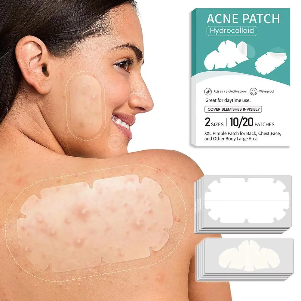 10/20/152/198pcs Closed Pimple Master Patch Invisible Absorption Secretions Skin Colloidal Care Makeup Breathable Mask Beau C1H8