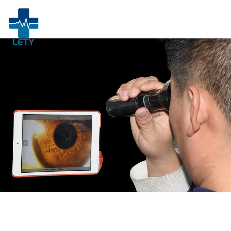 WIFI Ophthalmoscope wireless Iris endoscopy wireless portable digital microscope