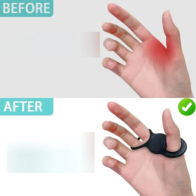 1pairSilicone Baseball Thumb Protector Swing Training Aid Hand Guard Baseball Field Unisex Design Softball Training
