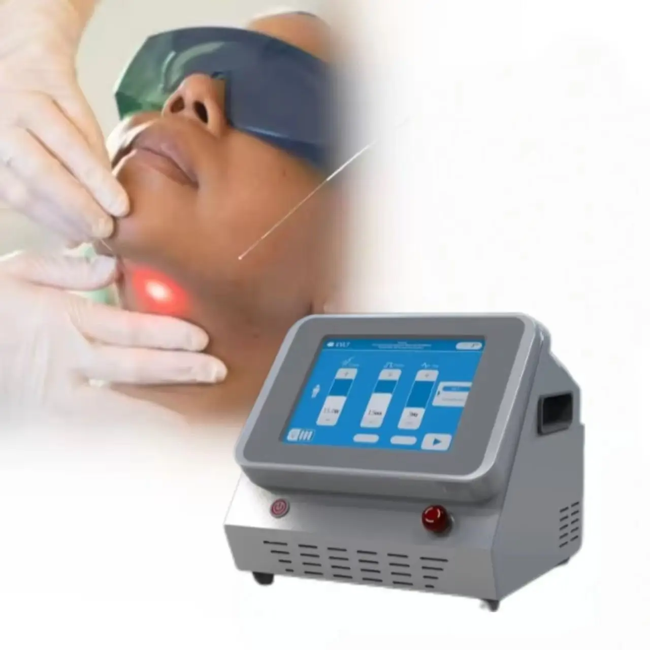 Chinese Factories Promote 980-Nanometer Liposuction Machines Plastic Surgery Fiber Lipolysis Diode Fat Laser Beauty Equipment