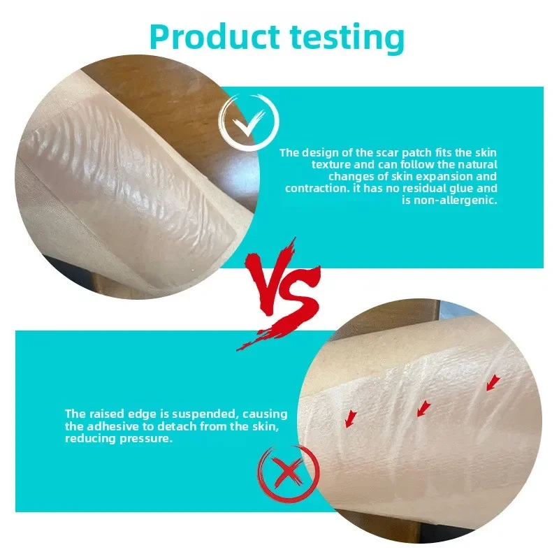 1 Roll Silicone Scar Sheets Self-Adhesive Scar Cover Tape Reusable and Effective Skin Care Strips Silicone Scar Sheets4cmX150cm