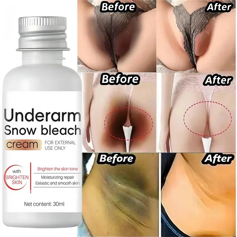 

Whitening Cream Private Parts Underarm Bleaching Serum Whiten Butt Knee Brighten Inner Thigh Intimate Parts Dark Remove Melanin