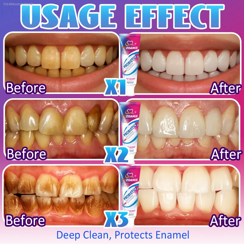 Teeth Whitening Toothpaste, Gentle Daily Oral Care Paste, Helps Remove Tea Stains, Coffee Stains and Smoke Stains on Tooth Surface, Brighten Teeth Appearance for Men Women