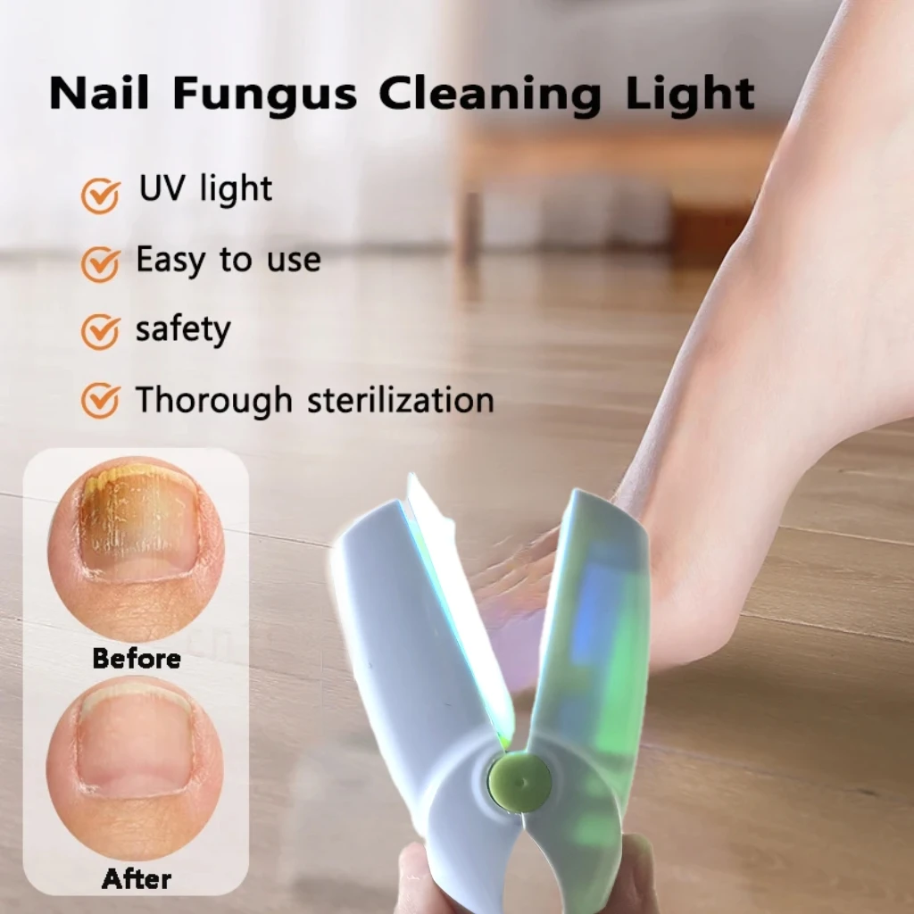 

Toenails Onychomycosis Home Anti Fungal Laser Equipment 470nm 905nm