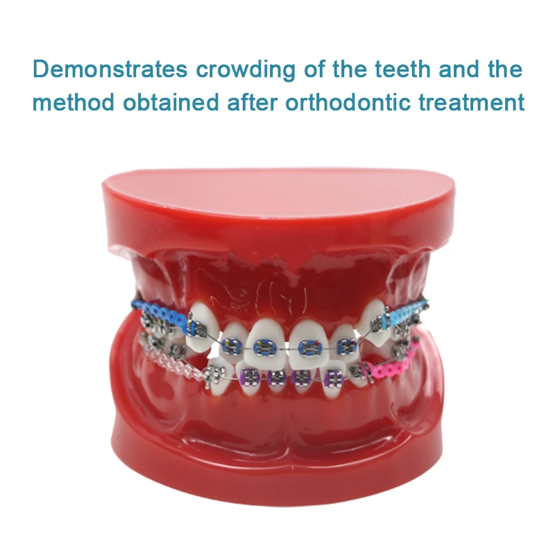 

Модель ортодонтических зубов, стоматологическая модель ортодонтических зубов Typodont 1:1, стандартные демонстрационные стоматологические принадлежности