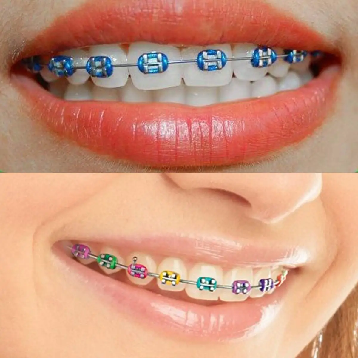 Mehrfarbige orthodontische elastische O-Ring-Gummibänder, mehrfarbige zahnärztliche Ligatur-Gummibänder, orthodontisches Ligaturring-Set - O-Ring-Zahnligaturringe für orthodontische Behandlung und Zahnspangen, 48 Farbe – Detail 14