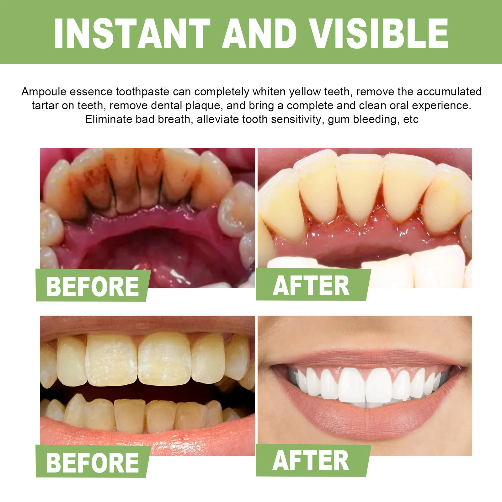 Effective Teeth Whitening Products Professional Dental Whitening Clean Smoke Coffee Stains Tartar Temoval Bleach Teeth Whitener