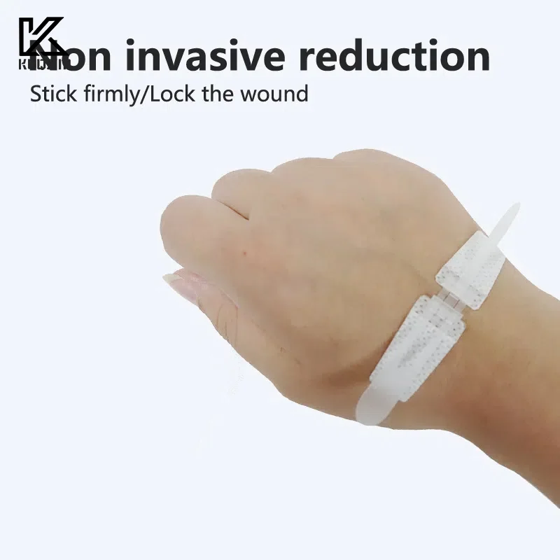 Zipper Band-aid Painless Wound Closure Device Suture-free Wound Dressing Patches Zip Suture Reducer Band Aid Outdoor Portable