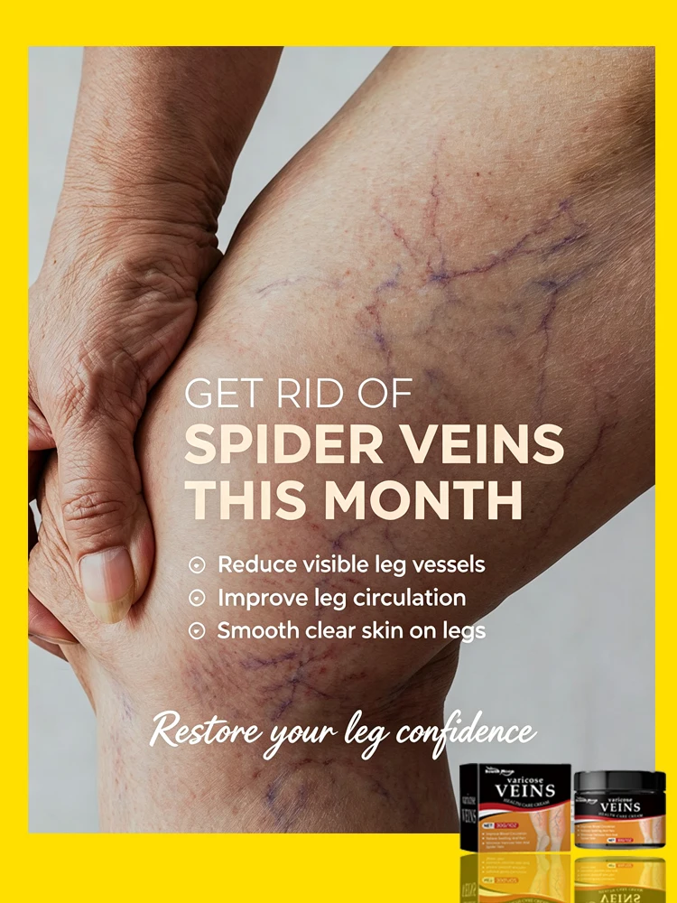 Herbal Varicose Veins Cream Leg Care Cream