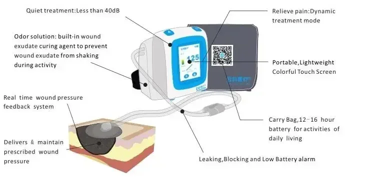negative pressure wound therapy machine with drainage canister 140ml/450ml & 10sets different size NPWT medical dressing kit image 5