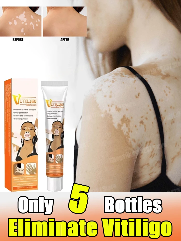 

Remove White Spot Removal Skin Vitiligo Eliminate Vitiligo Body Skin Care