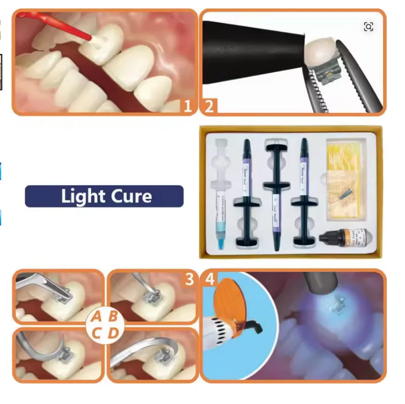 

Dentistry orthodontics adhesive suit material photocuring suite oral cavity bond nursing tooth enamel repair bracket Tools