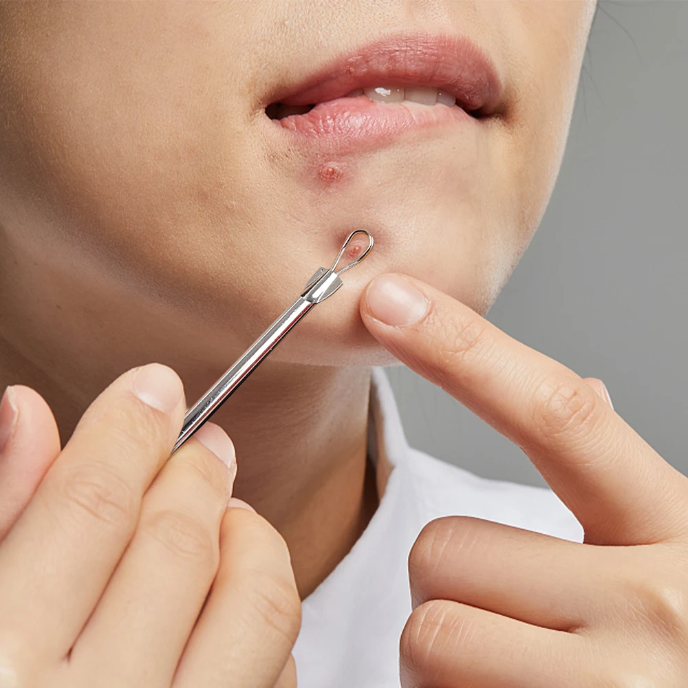 4 ピース/セットにきび除去針ステンレス鋼にきび傷にきび除去スプーン顔スキンケアツール顔毛穴クリーナー