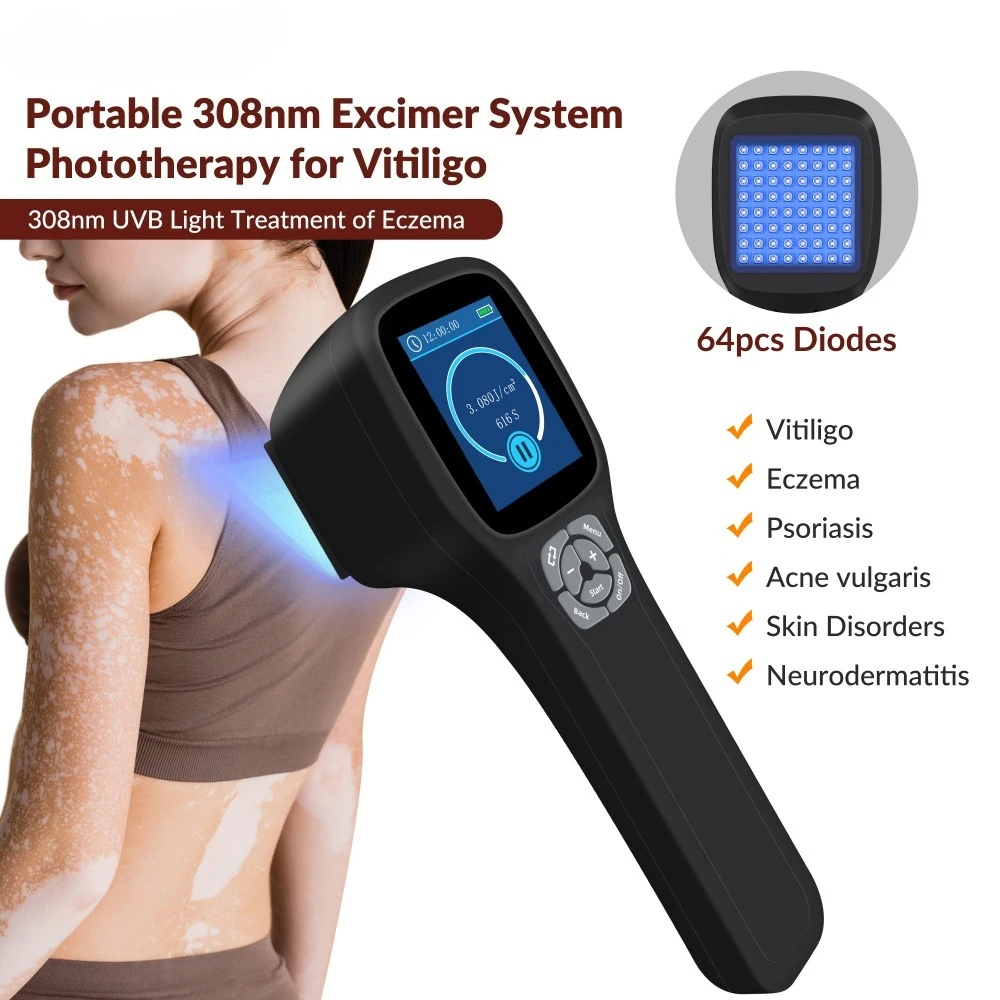 

Frovab медицинский класс 308 нм узкополосный УФ-светотерапевтический аппарат 64 диода портативное устройство для восстановления кожи лечение витилиго