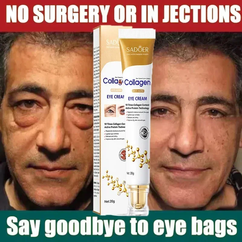 Fast Instant Eye Bag Removal Cream Collagen Removal Wrinkles Firming Skin Fade Fine Lines Brighten Dark Circle Remove Eye Care