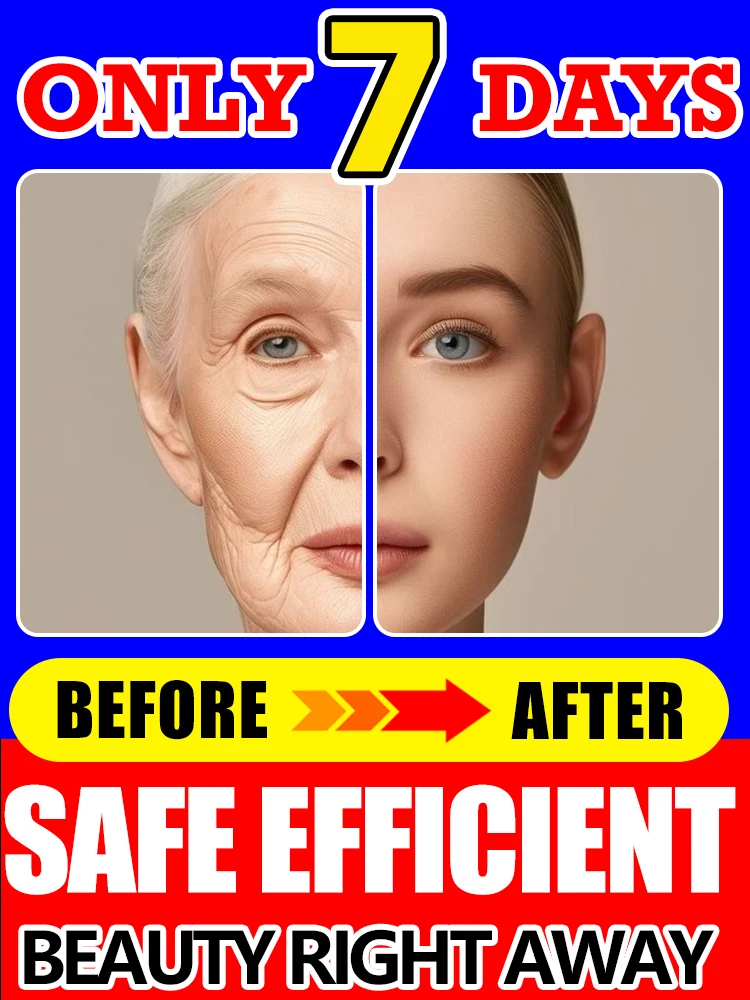 

Wrinkles improve to become beautiful now