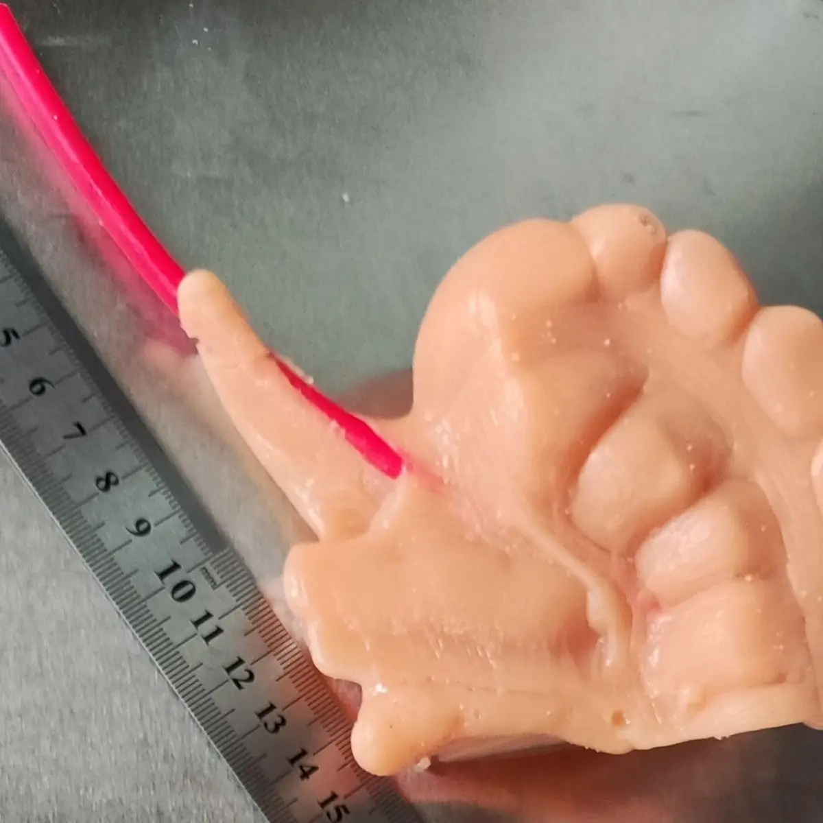 

3D-модуль для лапароскопической апендэктомии