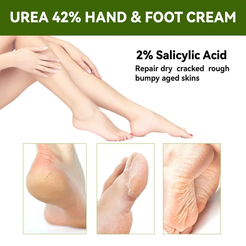 Crème Anti-fissure à base de plantes pour les pieds, réparation des fissures du talon, exfoliant, élimination des peaux mortes, callosités, hydrate, lisse, soins pour la peau
