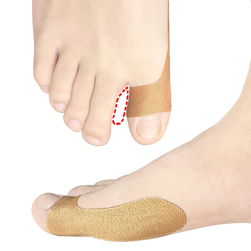 2/10/20 buah koreksi jempol Patch besar korektor jari kaki pengatur Finger Toe Patch pelindung Hallux Valgus ortopedi stiker