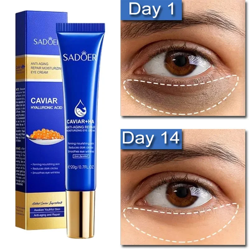 

Caviar Dark Circles Eye Cream Hyaluronic Acid Anti-Wrinkle Moisturizing Remove Eye Bags Puffiness Firming Skin Fade Fine Lines