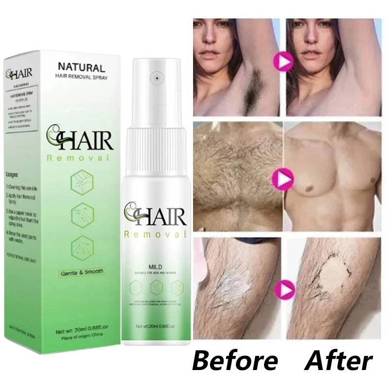 2 Minutes Fast Hair Removal Spray Painless Hair Growth Inhibitor Leg Arm Armpit Permanent Depilatory for Men Women Repair Care