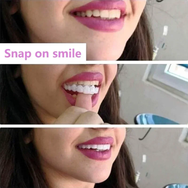 Perfect Fit Tanden Whitening Fake Tooth Cover Snap On Silicone Smile Facings Tanden Bovenste Beauty Tool Cosmetische Tanden Gratis verzending