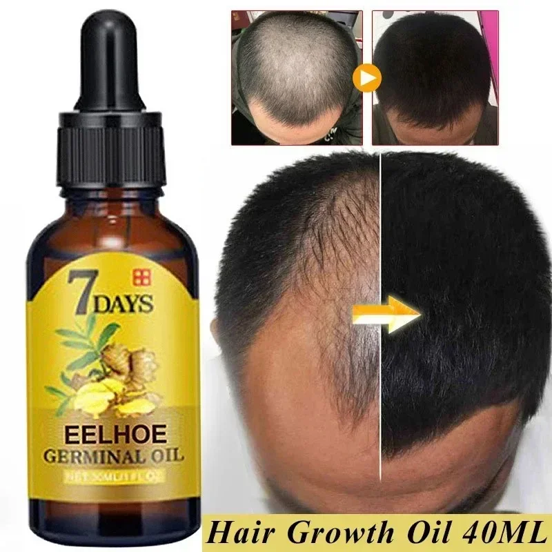 

7 Days Fast Ginger Hair Growth Serum Anti-loss Hair Regrowth Essential Oil Repair Damaged Hair Roots Hairs Care For Women Men